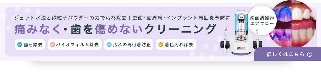 歯面清掃器エアフロー ジェット水流と微粒子パウダーの力で汚れ除去！虫歯・歯周病・インプラント周囲炎予防に 痛みなく・歯を傷めないクリーニング 歯石除去・バイオフィルム除去・汚れの再付着防止・着色汚れ除去　詳しく見る