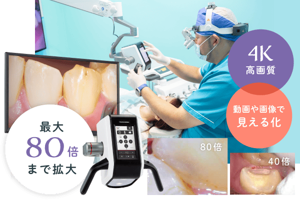 最大80倍まで拡大　4K高画質　動画や画像で見える化