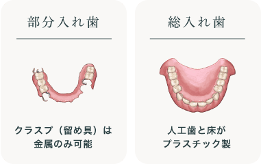 部分入れ歯（留め具は金属のみ使用）総入れ歯（人工歯と床がプラスチック製）