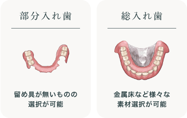 部分入れ歯（留め具が無いものの選択が可能）総入れ歯（金属床など様々な素材選択が可能）
