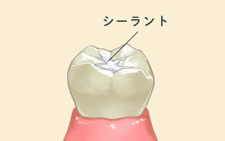 *